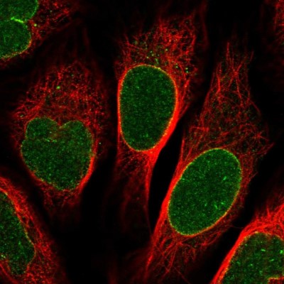 Immunocytochemistry/Immunofluorescence: NUP155 Antibody [NBP1-82960] - Immunofluorescent staining of human cell line U-2 OS shows localization to nuclear membrane.