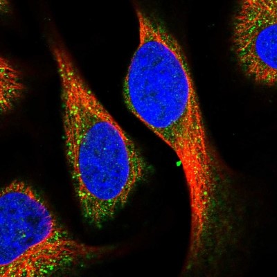 Immunocytochemistry/Immunofluorescence: Kv6.1 Antibody [NBP1-81572] - Immunofluorescent staining of human cell line U-2 OS shows localization to vesicles.