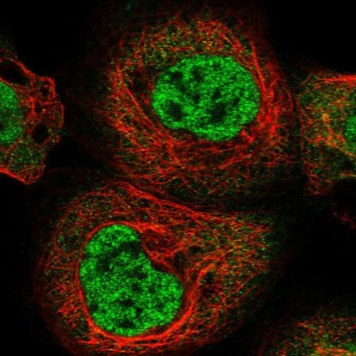 Immunocytochemistry/Immunofluorescence: RBM15B Antibody [NBP1-81650] - Staining of human cell line A-431 shows localization to nucleoplasm.