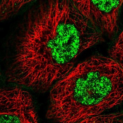 Immunocytochemistry/Immunofluorescence: CDC42SE2 Antibody [NBP1-82131] - Staining of human cell line A-431 shows positivity in nucleus but not nucleoli, plasma membrane and vesicles.