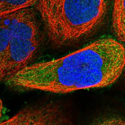 Immunocytochemistry/Immunofluorescence: PLEKHA7 Antibody [NBP1-85045] - Immunofluorescent staining of human cell line A-431 shows localization to nucleus, cytosol & cell junctions.