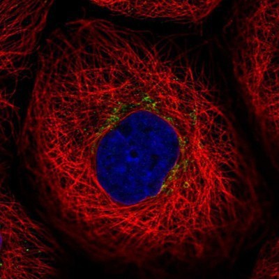 Immunocytochemistry/Immunofluorescence: EYA2 Antibody [NBP1-84026] - Staining of human cell line A-431 shows positivity in mitochondria.
