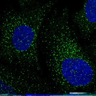 Immunocytochemistry/Immunofluorescence: BTBD3 Antibody [NBP1-84214] - Staining of human cell line U-2 OS shows positivity in vesicles.