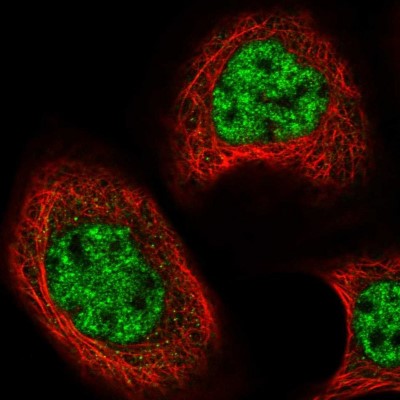 Immunocytochemistry/Immunofluorescence: Cbx8 Antibody [NBP1-83224] - Immunofluorescent staining of human cell line A-431 shows localization to nucleoplasm.