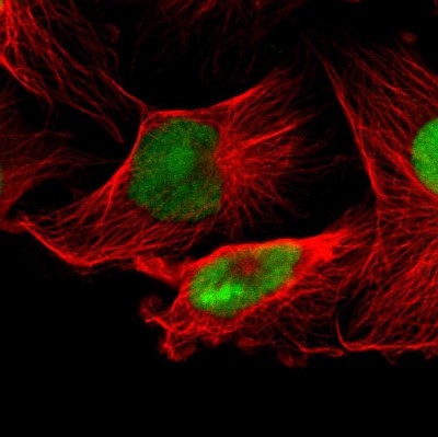 Immunocytochemistry/Immunofluorescence: IFI16 Antibody [NBP1-83118] - Staining of human cell line U-251 MG shows localization to nucleus & nucleoli.