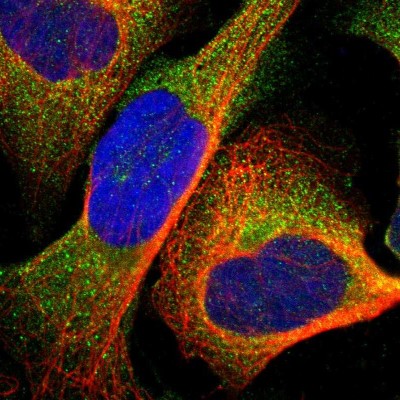 Immunocytochemistry/Immunofluorescence: UPF3B Antibody [NBP1-83134] - Immunofluorescent staining of human cell line U-2 OS shows localization to cytosol.