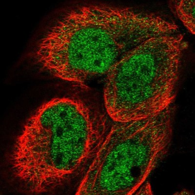 Immunocytochemistry/Immunofluorescence: DCAF11 Antibody [NBP1-83364] - Immunofluorescent staining of human cell line A-431 shows localization to nucleoplasm.