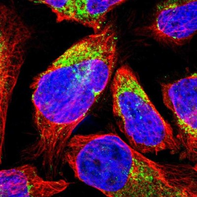 Immunocytochemistry/Immunofluorescence: MCCC1 Antibody [NBP1-81254] - Immunofluorescent staining of human cell line U-2 OS shows localization to mitochondria.