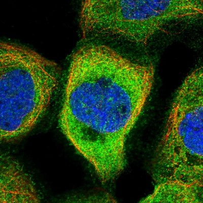Immunocytochemistry/Immunofluorescence: NARFL Antibody [NBP1-83611] - Immunofluorescent staining of human cell line A-431 shows localization to plasma membrane & cytosol.