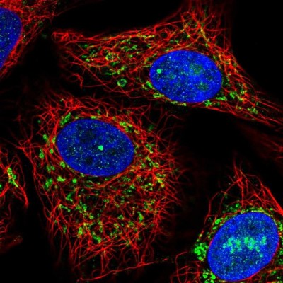Immunocytochemistry/Immunofluorescence: ACADVL Antibody [NBP1-89287] - Immunofluorescent staining of human cell line A549 shows localization to nucleus, nucleoli & mitochondria.