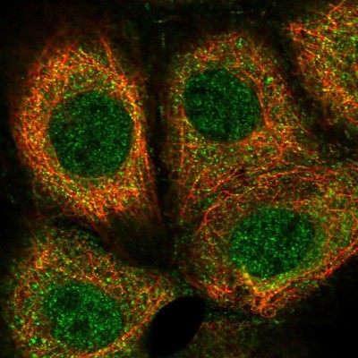 Immunocytochemistry/Immunofluorescence: Trim11 Antibody [NBP1-88609] - Immunofluorescent staining of human cell line A-431 shows localization to nucleus & cytosol.