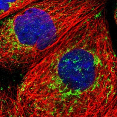 Immunocytochemistry/Immunofluorescence: ECHS1 Antibody [NBP1-87079] - Immunofluorescent staining of human cell line A-431 shows localization to mitochondria.