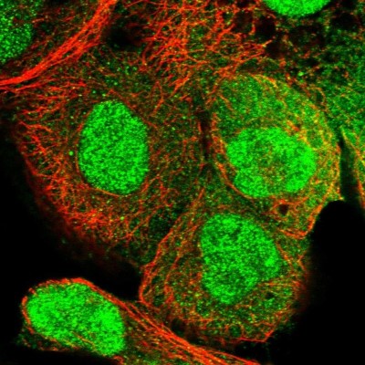 Immunocytochemistry/Immunofluorescence: RECQL5 Antibody [NBP1-83438] - Immunofluorescent staining of human cell line A-431 shows localization to nucleus & cytosol.