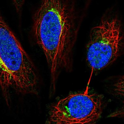 Immunocytochemistry/Immunofluorescence: NETO2 Antibody [NBP1-84624] - Immunofluorescent staining of human cell line SiHa shows localization to the Golgi apparatus.