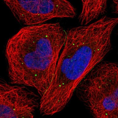 Immunocytochemistry/Immunofluorescence: SNRK Antibody [NBP1-83668] - Staining of human cell line U-2 OS shows localization to cell junctions & vesicles.