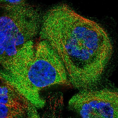 Immunocytochemistry/Immunofluorescence: CHORDC1 Antibody [NBP1-85629] - Immunofluorescent staining of human cell line A-431 shows localization to cytosol.
