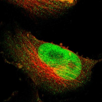 Immunocytochemistry/Immunofluorescence: NFRKB Antibody [NBP1-85096] - Immunofluorescent staining of human cell line U-251 MG shows localization to nucleus.