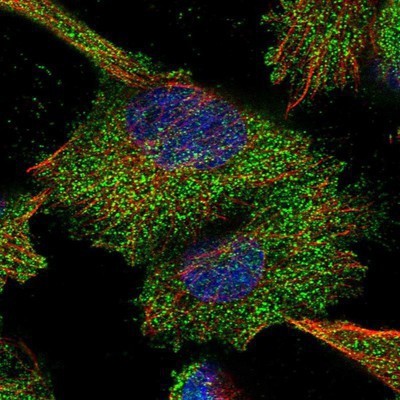 Immunocytochemistry/Immunofluorescence: HOMER2 Antibody [NBP1-85487] - Staining of human cell line U-251 MG shows positivity in plasma membrane and cytoplasm.