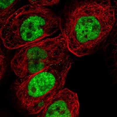 Immunocytochemistry/Immunofluorescence: RNA Helicase A Antibody [NBP1-85266] - Immunofluorescent staining of human cell line A-431 shows localization to nucleoplasm.