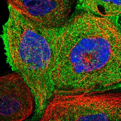 Immunocytochemistry/Immunofluorescence: ENKD1 Antibody [NBP1-85147] - Immunofluorescent staining of human cell line A-431 shows localization to plasma membrane & cytosol.