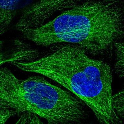 Immunocytochemistry/Immunofluorescence: KIF18A Antibody [NBP1-85126] - Staining of human cell line U-2 OS shows localization to cytosol, microtubules & cytokinetic bridge.