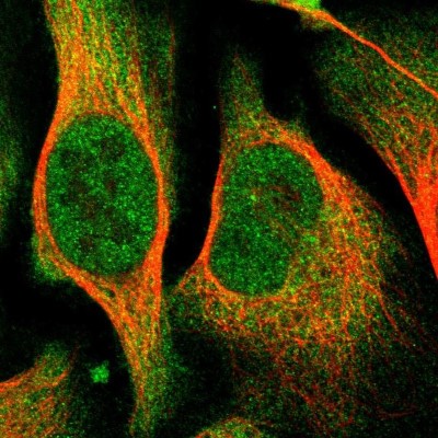 Immunocytochemistry/Immunofluorescence: COASY Antibody [NBP1-84990] - Immunofluorescent staining of human cell line U-2 OS shows localization to nucleoplasm & cytosol.