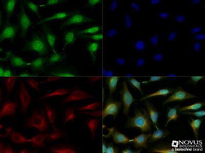 Immunocytochemistry/Immunofluorescence: HIPK3 Antibody [NBP2-24521] - HeLa cells were fixed for 10 minutes using 10% formalin and then permeabilized for 5 minutes using 1X TBS + 0.5% Triton-X100. The cells were incubated with anti-HIPK3 [NBP2-24521] at a 1:200 dilution overnight at 4C and detected with an anti-rabbit Dylight 488 (Green) at a 1:500 dilution. Alpha tubulin (DM1A) NB100-690 was used as a co-stain at a 1:1000 dilution and detected with an anti-mouse Dylight 550 (Red) at a 1:500 dilution. Nuclei were counterstained with DAPI (Blue). Cells were imaged using a 40X objective. 