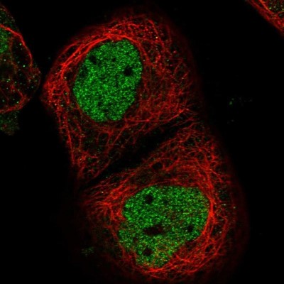 Immunocytochemistry/Immunofluorescence: GMPPA Antibody [NBP1-85904] - Staining  of human cell line A-431 shows positivity in nucleus but not nucleoli.