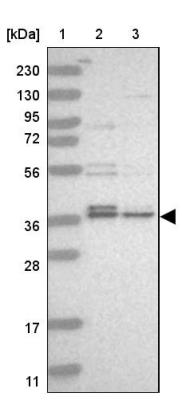 Western Blot: C1orf131 Antibody [NBP1-85098] - Lane 1: Marker  [kDa] 230, 130, 95, 72, 56, 36, 28, 17, 11.  Lane 2: Human cell line RT-4.  Lane 3: Human cell line U-251MG sp