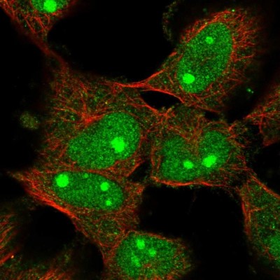 Immunocytochemistry/Immunofluorescence: C1orf131 Antibody [NBP1-85098] - Immunofluorescent staining of human cell line U-251 MG shows localization to nucleus & nucleoli.