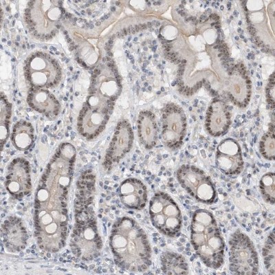 Immunohistochemistry-Paraffin: C1orf131 Antibody [NBP1-85098] - Staining of human duodenum shows cytoplasmic and nucleoli positivity in glandular cells.