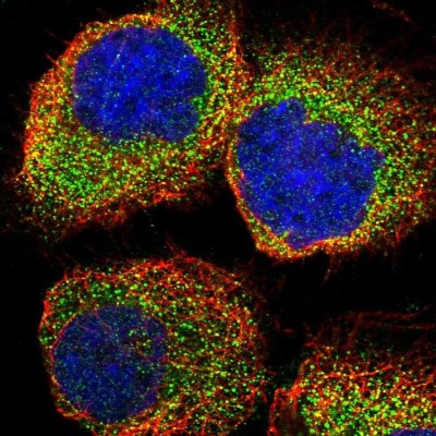 Immunocytochemistry/Immunofluorescence: DDAH2 Antibody [NBP1-86092] - Staining  of human cell line A-431 shows positivity in cytoplasm.