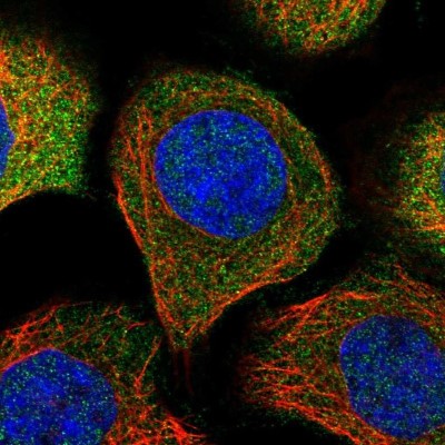 Immunocytochemistry/Immunofluorescence: NDRG3 Antibody [NBP1-86046] - Staining  of human cell line A-431 shows positivity in cytoplasm.