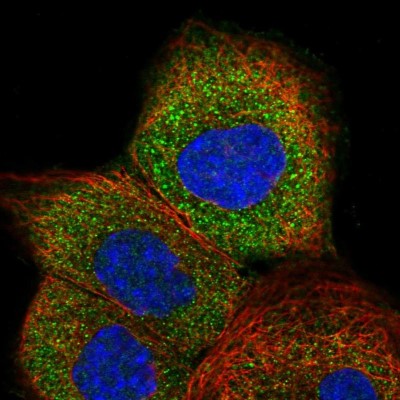 Immunocytochemistry/Immunofluorescence: GTPBP2 Antibody [NBP1-85924] - Immunofluorescent staining of human cell line A-431 shows localization to vesicles.