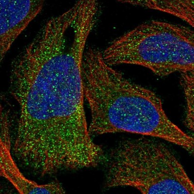 Immunocytochemistry/Immunofluorescence: GTPBP2 Antibody [NBP1-85924] - Staining  of human cell line U-2 OS shows positivity in cytoplasm.