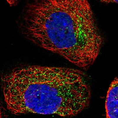 Immunocytochemistry/Immunofluorescence: ACRC Antibody [NBP1-85993] - Immunofluorescent staining of human cell line A-431 shows localization to vesicles.