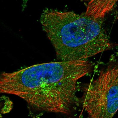 Immunocytochemistry/Immunofluorescence: ACRC Antibody [NBP1-85993] - Staining  of human cell line U-251MG shows positivity in golgi apparatus and vesicles.