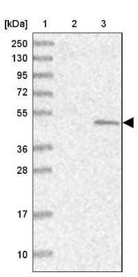 Western Blot: Sulfatase Modifying Factor 1/SUMF1 Antibody [NBP1-83905] - Lane 1: Marker  [kDa] 250, 130, 95, 72, 55, 36, 28, 17, 10.  Lane 2: Human cell line RT-4.  Lane 3: Human cell line U-251MG sp