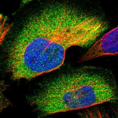 Immunocytochemistry/Immunofluorescence: CCDC6 Antibody [NBP1-85351] - Immunofluorescent staining of human cell line U-251 MG shows localization to cytosol.