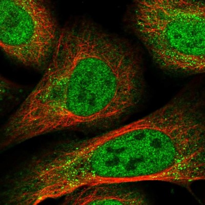 Immunocytochemistry/Immunofluorescence: RFX3 Antibody [NBP1-86301] - Immunofluorescent staining of human cell line U-2 OS shows localization to nucleoplasm & vesicles.