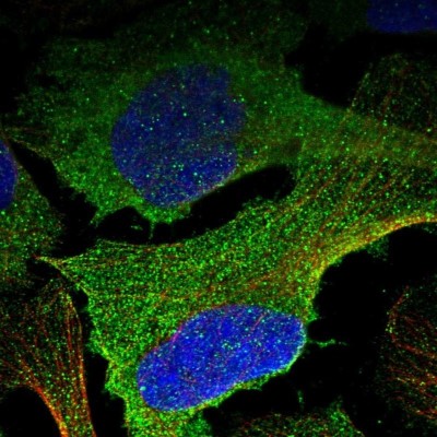 Immunocytochemistry/Immunofluorescence: BHMT2 Antibody [NBP1-85826] - Staining  of human cell line U-2 OS shows positivity in plasma membrane and cytoplasm.
