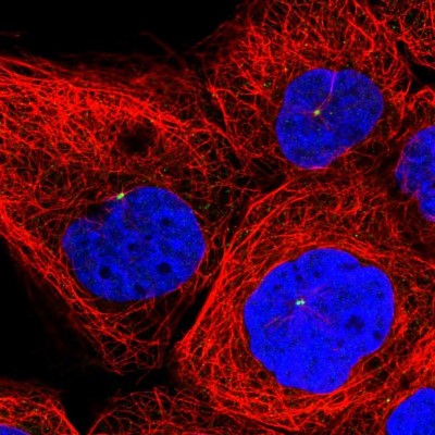 Immunocytochemistry/Immunofluorescence: INPP4B Antibody [NBP1-85883] - Immunofluorescent staining of human cell line A-431 shows localization to centrosome.