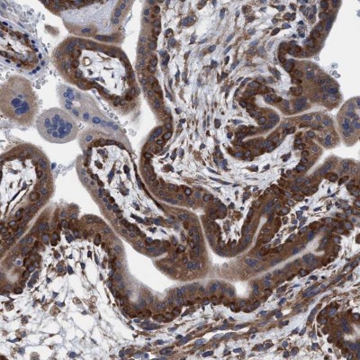 Immunocytochemistry/Immunofluorescence: NMT1 Antibody [NBP1-82547] - Staining of human placenta shows cytoplasmic positivity in trophoblastic cells.