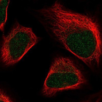 Immunocytochemistry/Immunofluorescence: SKIV2L2 Antibody [NBP1-84995] - Staining of human cell line U-2 OS shows positivity in nucleus.