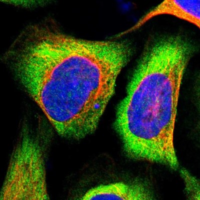 Immunocytochemistry/Immunofluorescence: EIF3S3 Antibody [NBP1-84870] - Immunofluorescent staining of human cell line U-2 OS shows localization to cytosol.