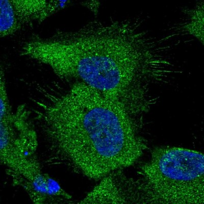 Immunocytochemistry/Immunofluorescence: ATP Citrate Lyase Antibody [NBP1-90267] - Immunofluorescent staining of human cell line U-251 MG shows localization to plasma membrane & cytosol.