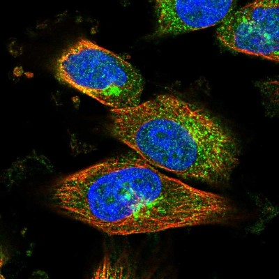 Immunocytochemistry/Immunofluorescence: RIN2 Antibody [NBP1-80854] - Immunofluorescent staining of human cell line U-251 MG shows localization to cytosol & the Golgi apparatus.