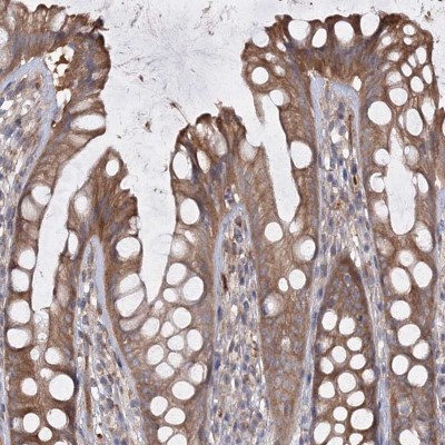 Immunocytochemistry/Immunofluorescence: RIN2 Antibody [NBP1-80854] - Staining of human rectum shows moderate cytoplasmic positivity in glandular cells.