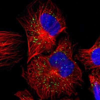 Immunocytochemistry/Immunofluorescence: JTB Antibody [NBP1-81746] - Immunofluorescent staining of human cell line U-251 MG shows localization to vesicles.