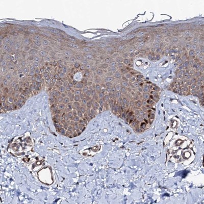 Immunocytochemistry/Immunofluorescence: FAM96A Antibody [NBP1-82100] - Staining of human skin shows moderate cytoplasmic positivity in most cell types.